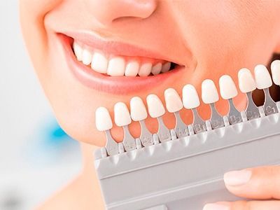 Una mujer sostiene una tabla de colores de dientes frente a sus dientes.