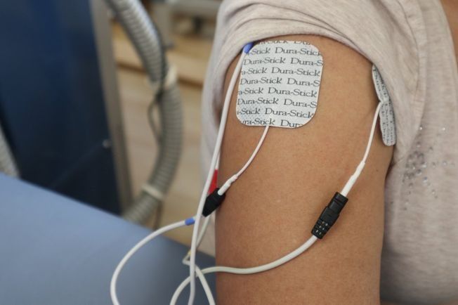 Un primer plano del brazo de una persona con electrodos.