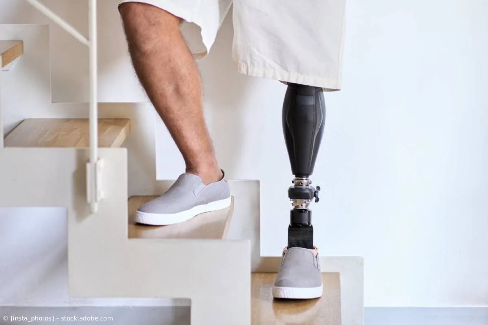 Person mit Beinprothese und Turnschuh steigt eine weiße Treppe hinunter