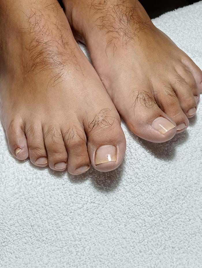 Dos pies con las uñas recién pintadas descansando sobre una toalla blanca.