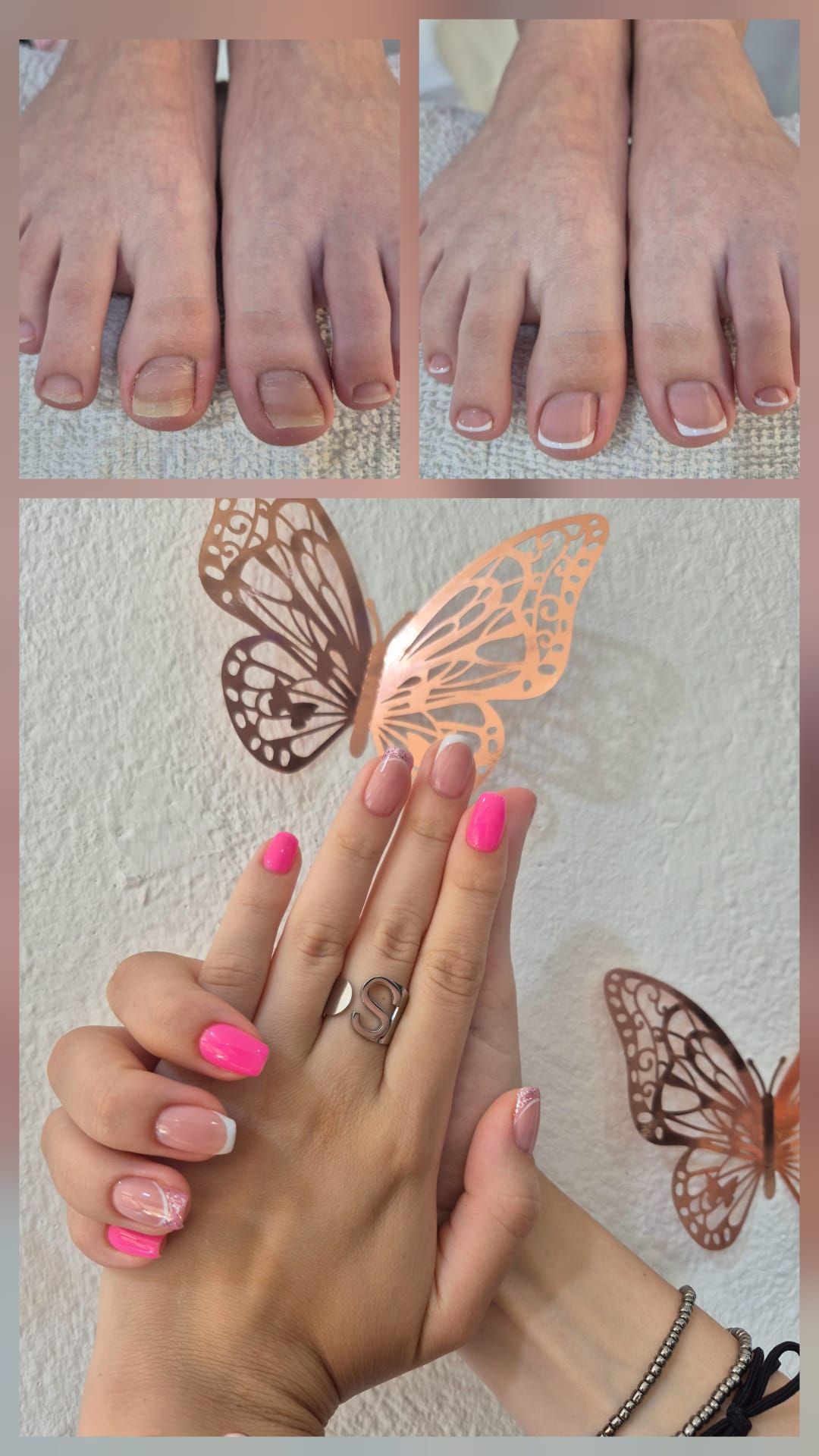 Una mujer con uñas rosas y un anillo en el dedo.