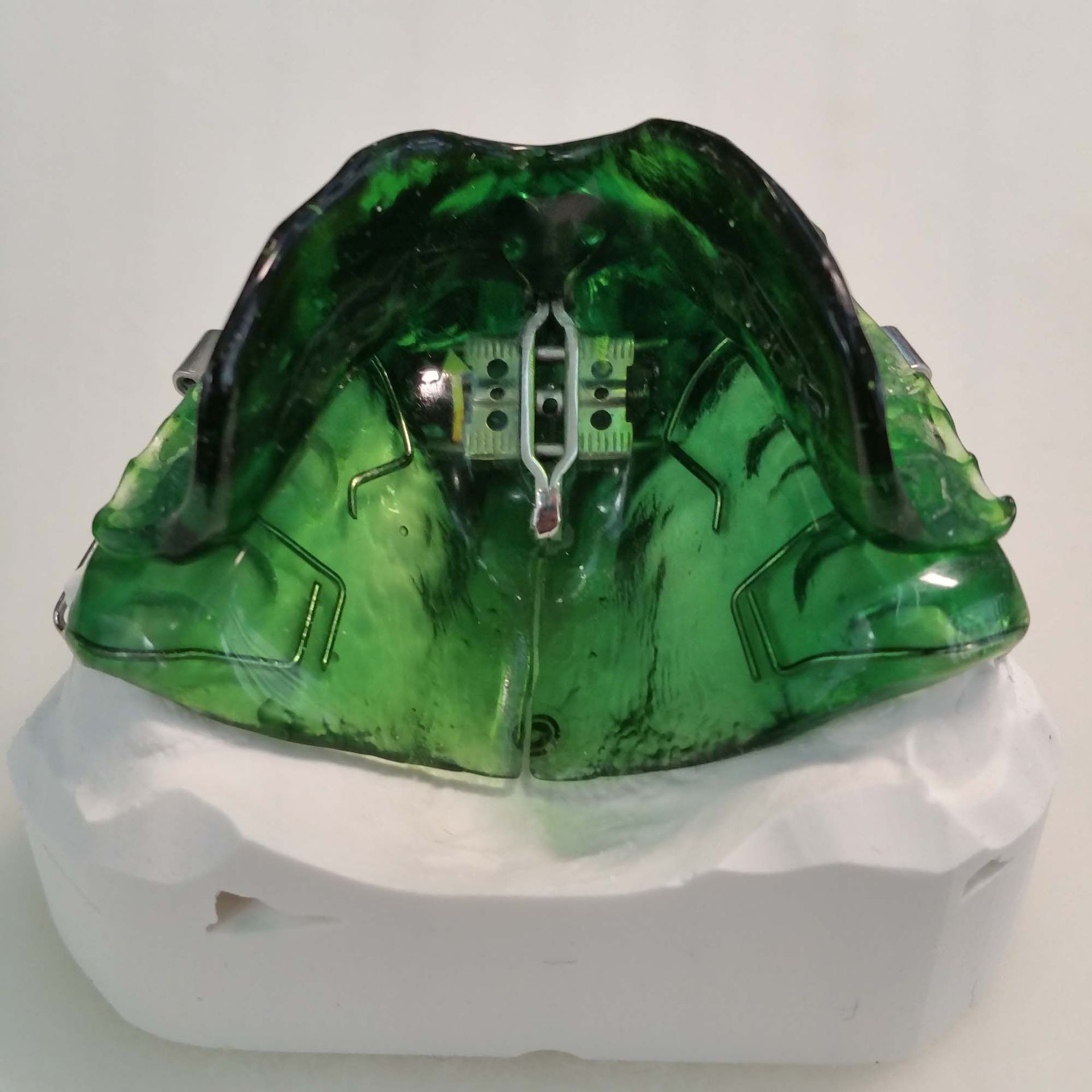 Monoblock, Aktivator - Zahntechnik Jentsch in Brig-Glis