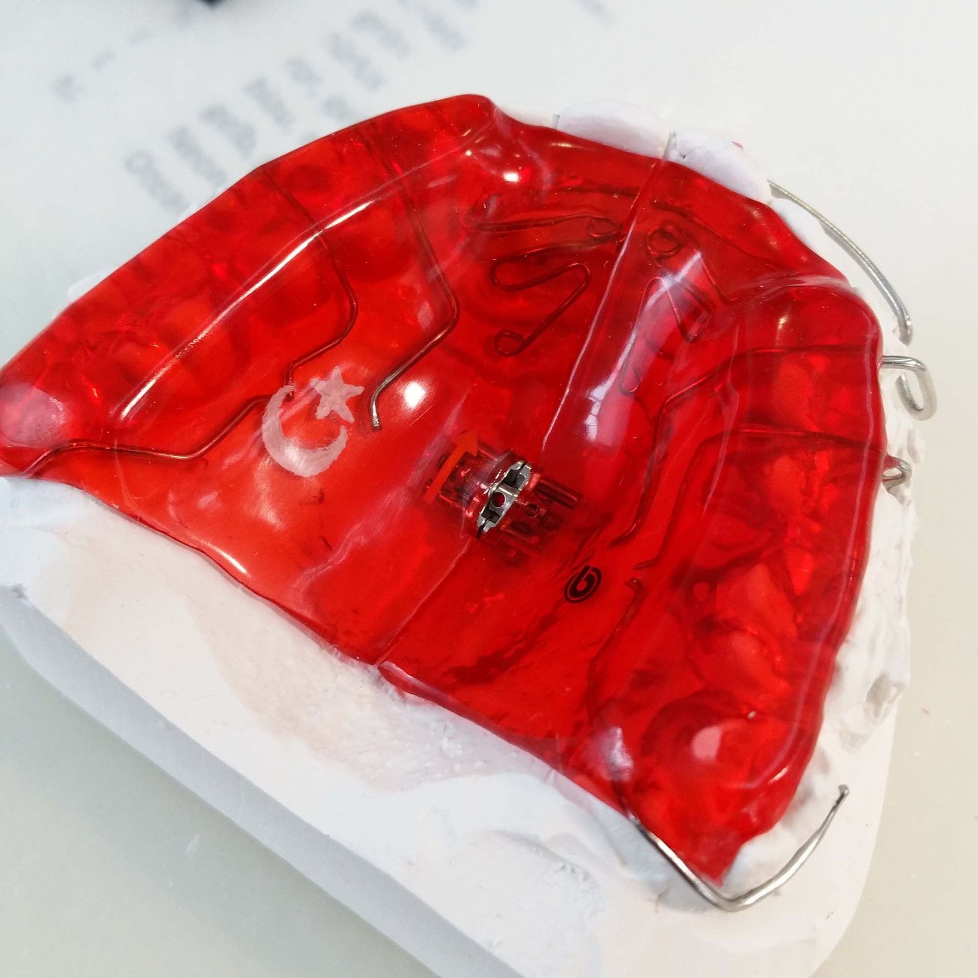 Aufbissplatte - Zahntechnik Jentsch in Brig-Glis