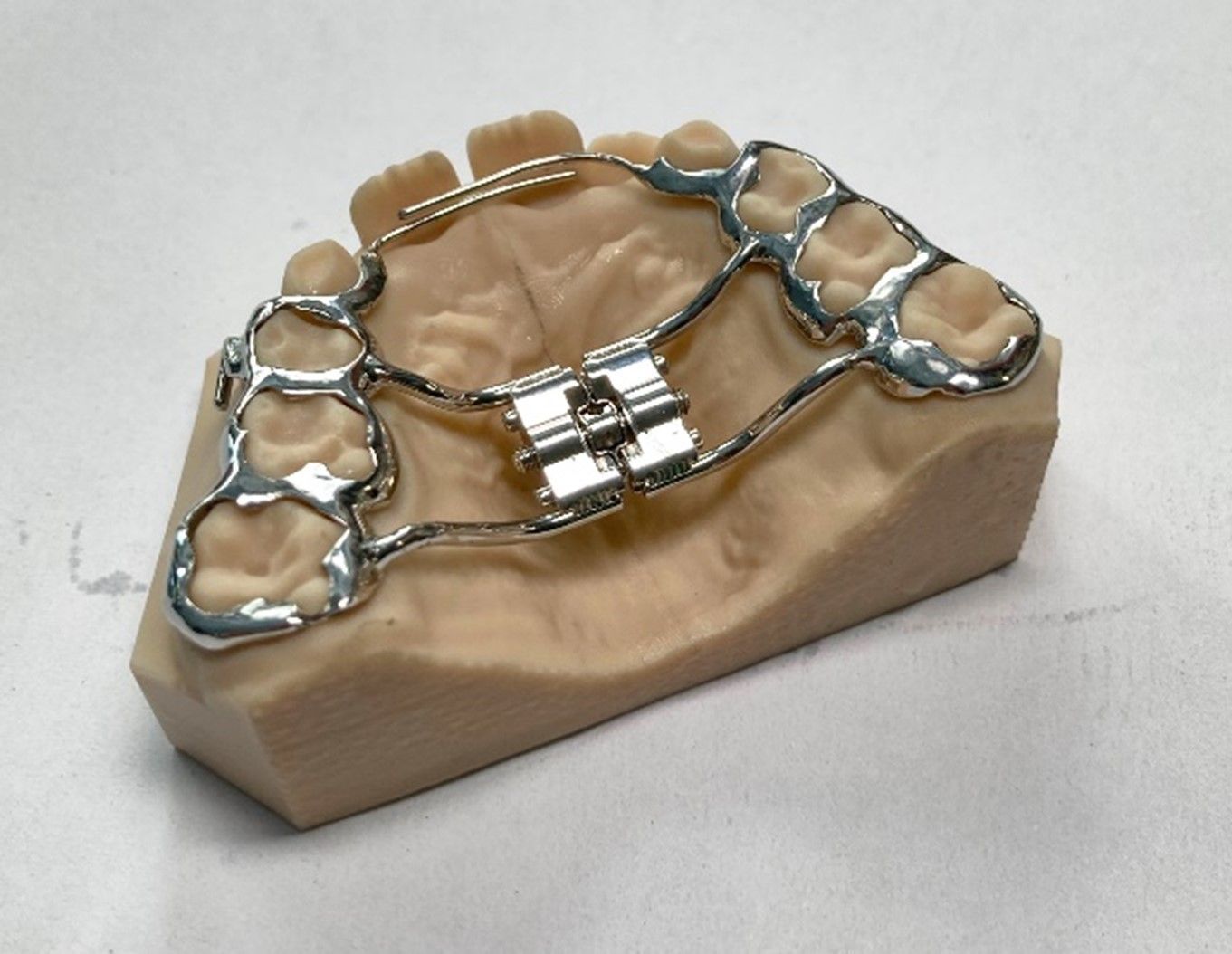 Die forcierte Dehnapparatur - Zahntechnik Jentsch in Brig-Glis