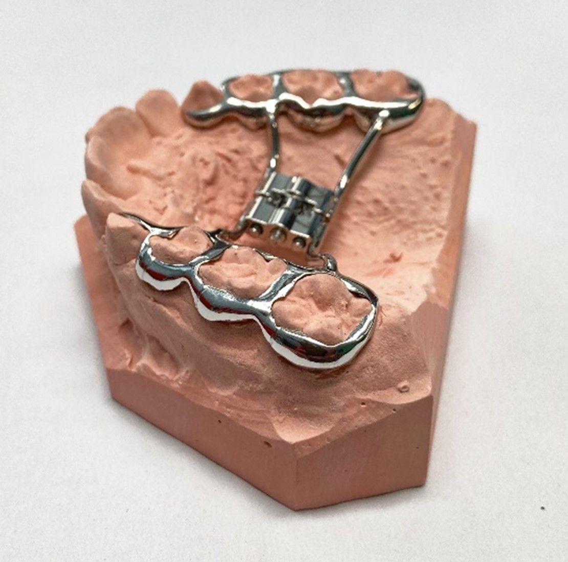 Die forcierte Dehnapparatur - Zahntechnik Jentsch in Brig-Glis