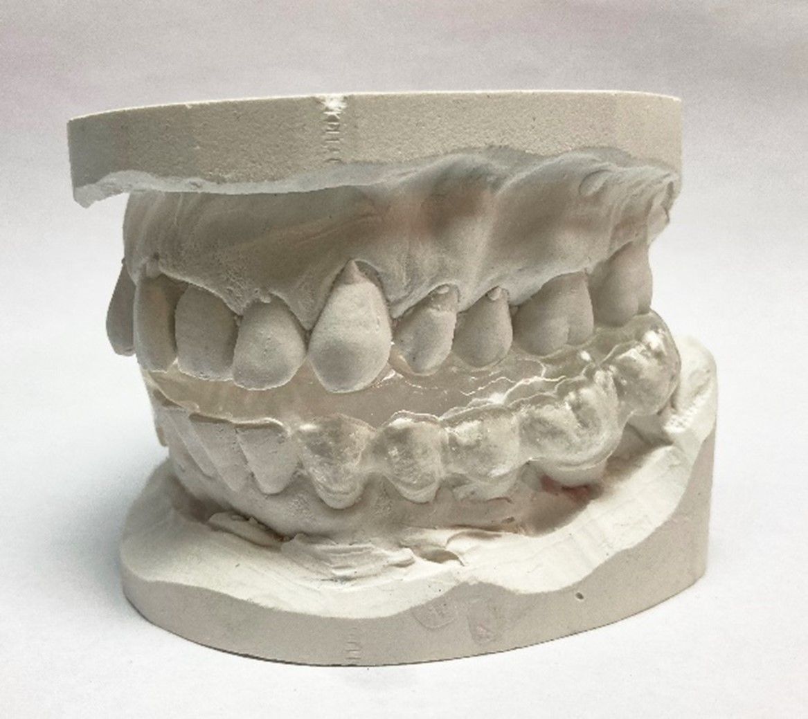 Copa - Zahntechnik Jentsch in Brig-Glis