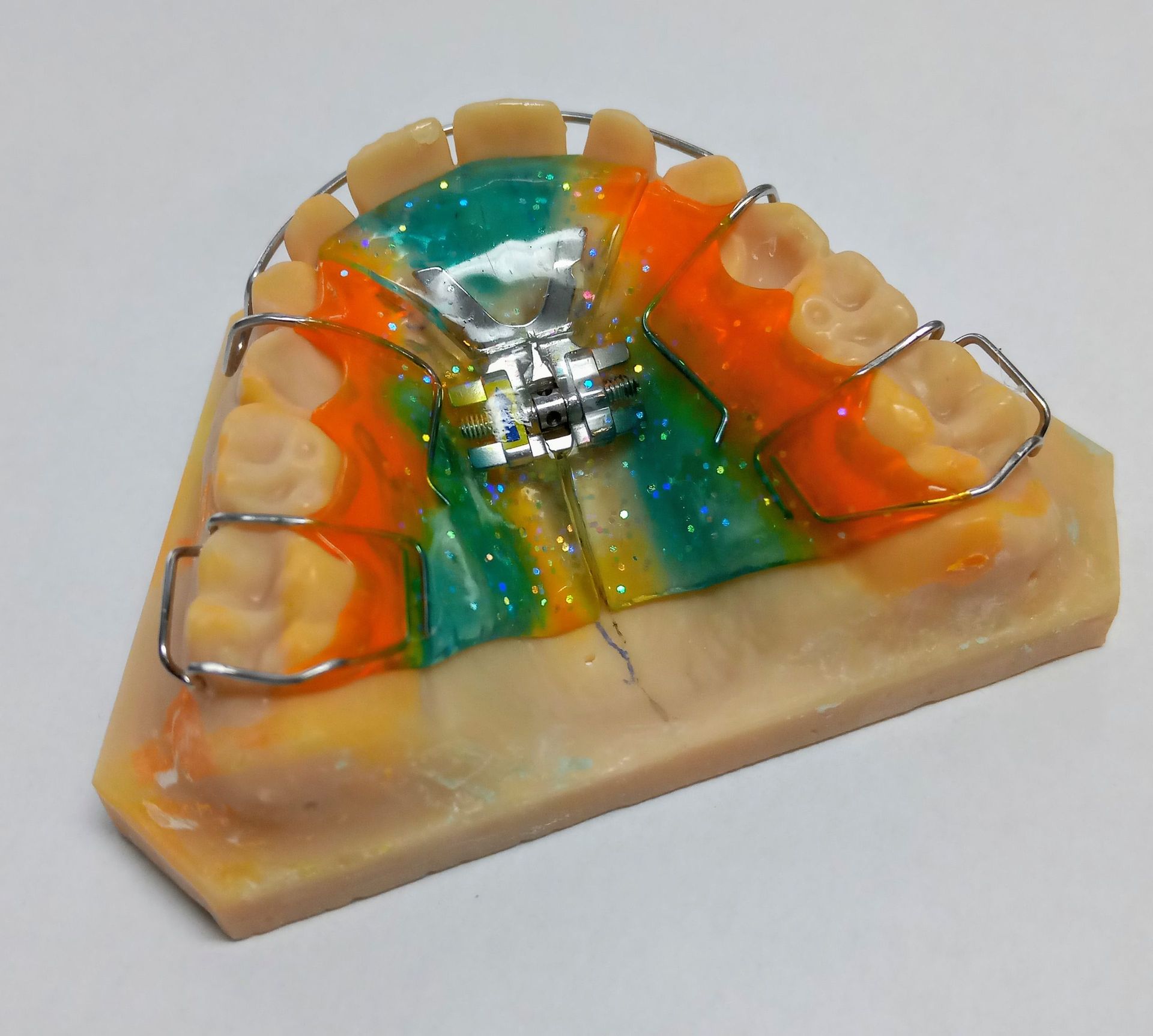 Dehnplatte - Zahntechnik Jentsch in Brig-Glis