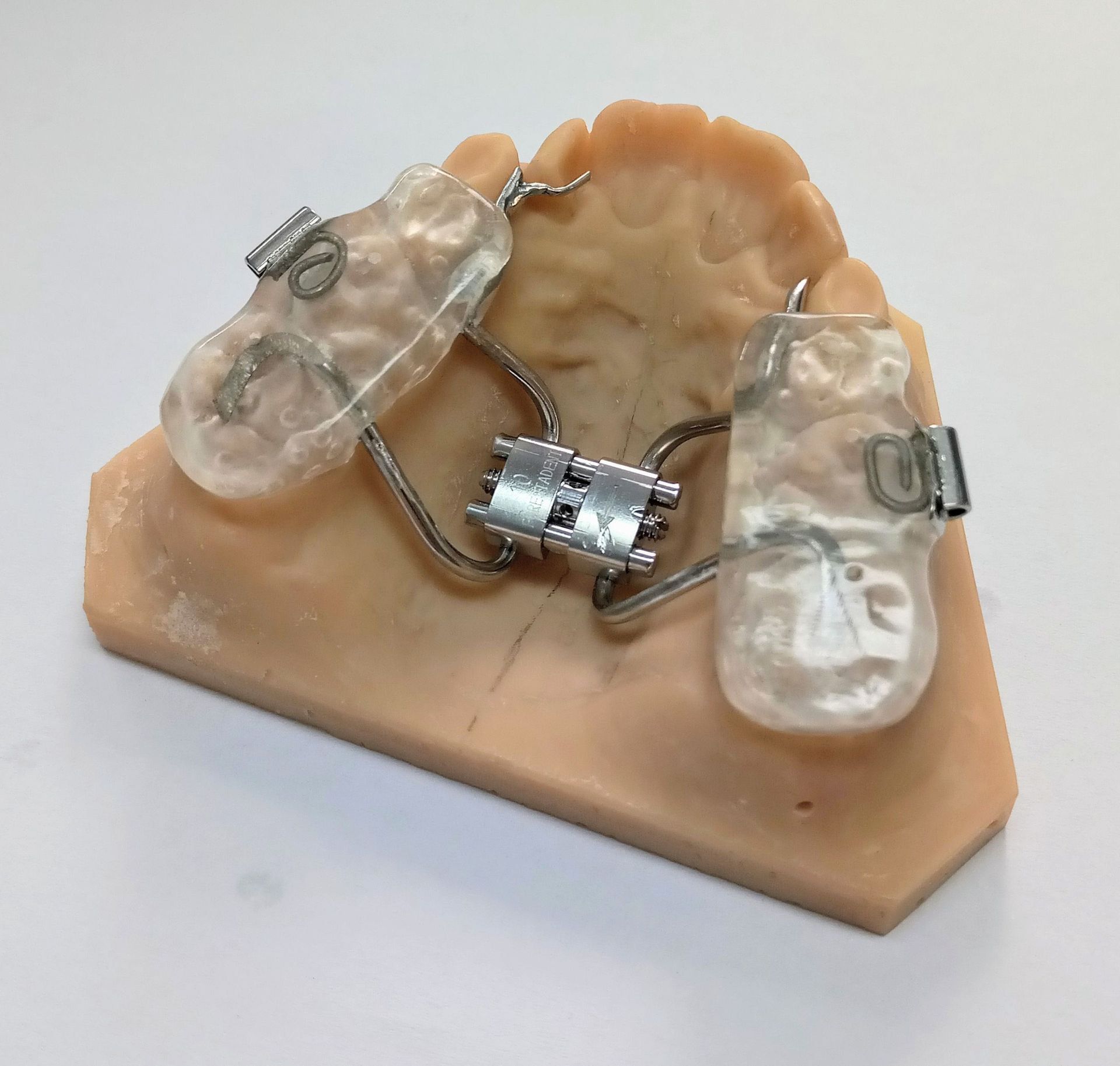 Lingualbogen - Zahntechnik Jentsch in Brig-Glis