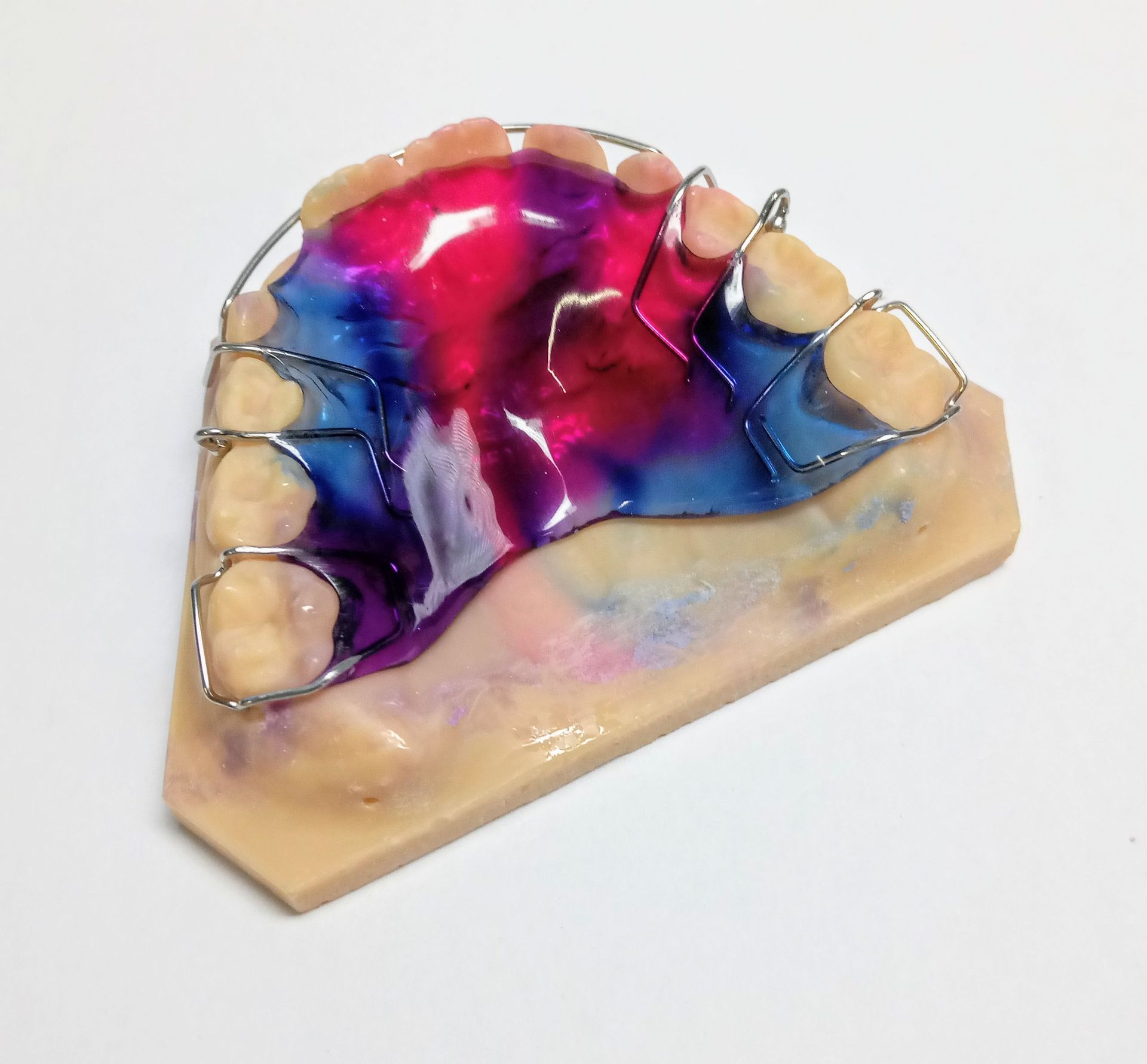 kieferorthopädie - Zahntechnik Jentsch in Brig-Glis