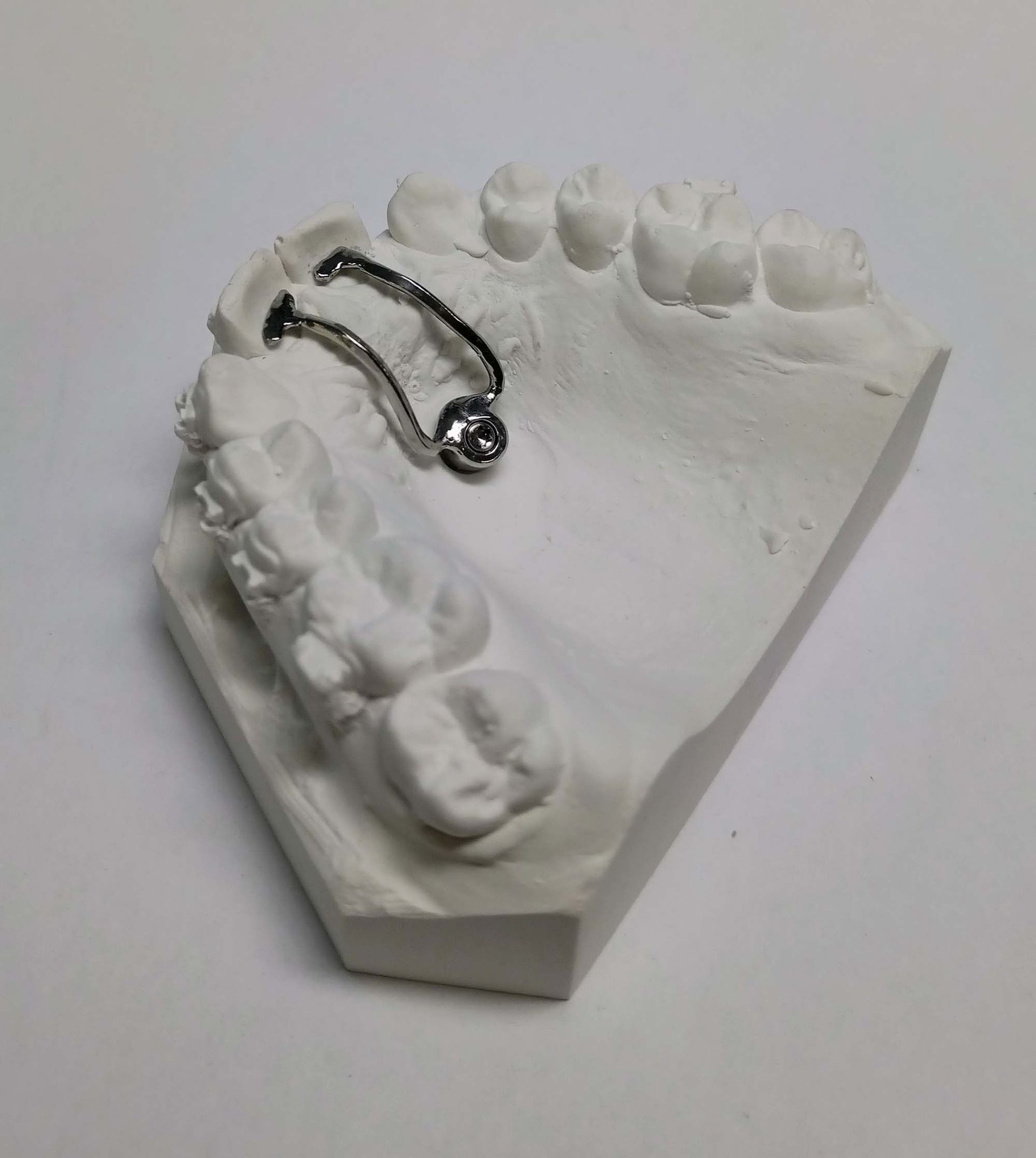 TPA - Zahntechnik Jentsch in Brig-Glis