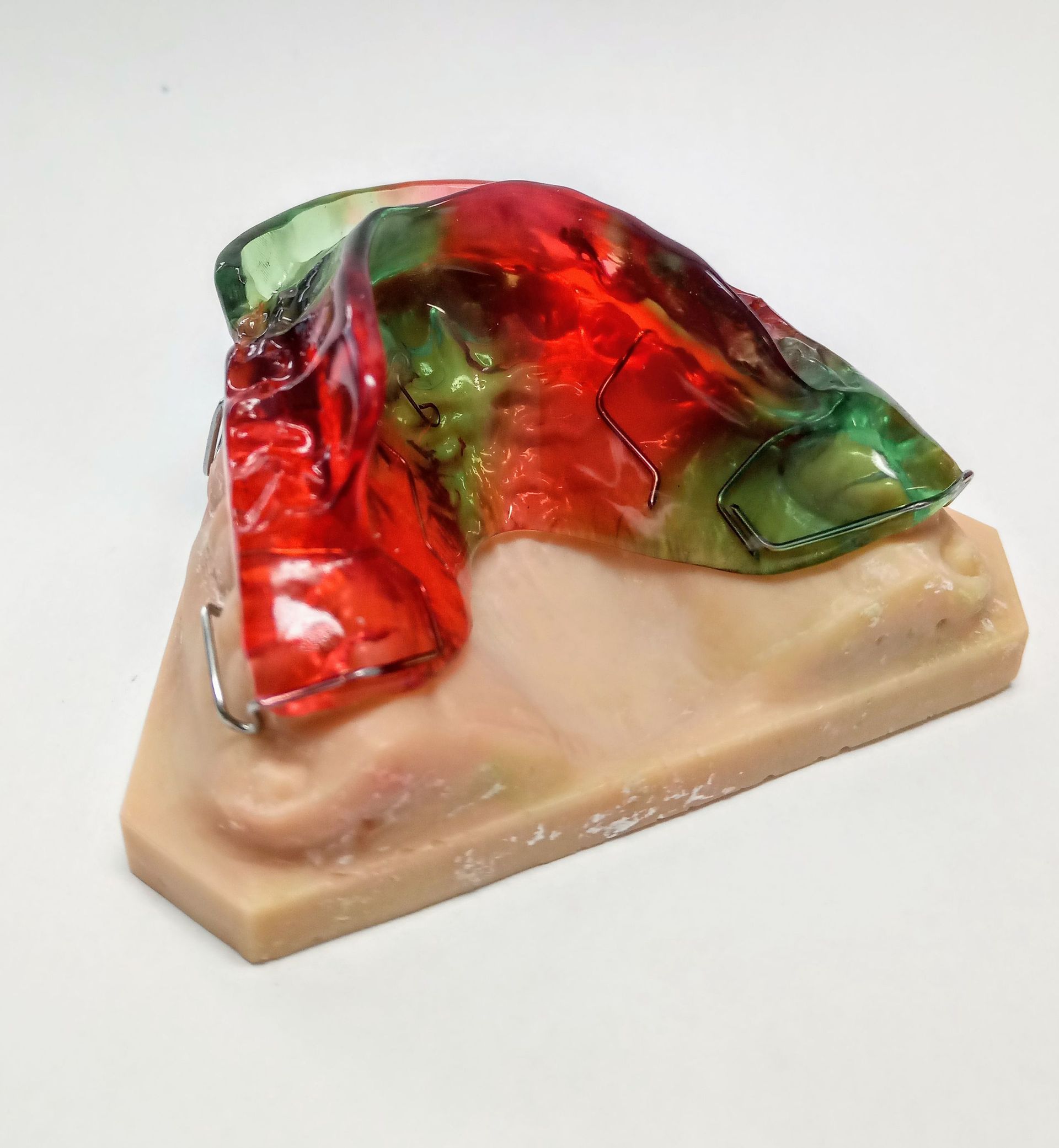 Monoblock, Aktivator - Zahntechnik Jentsch in Brig-Glis