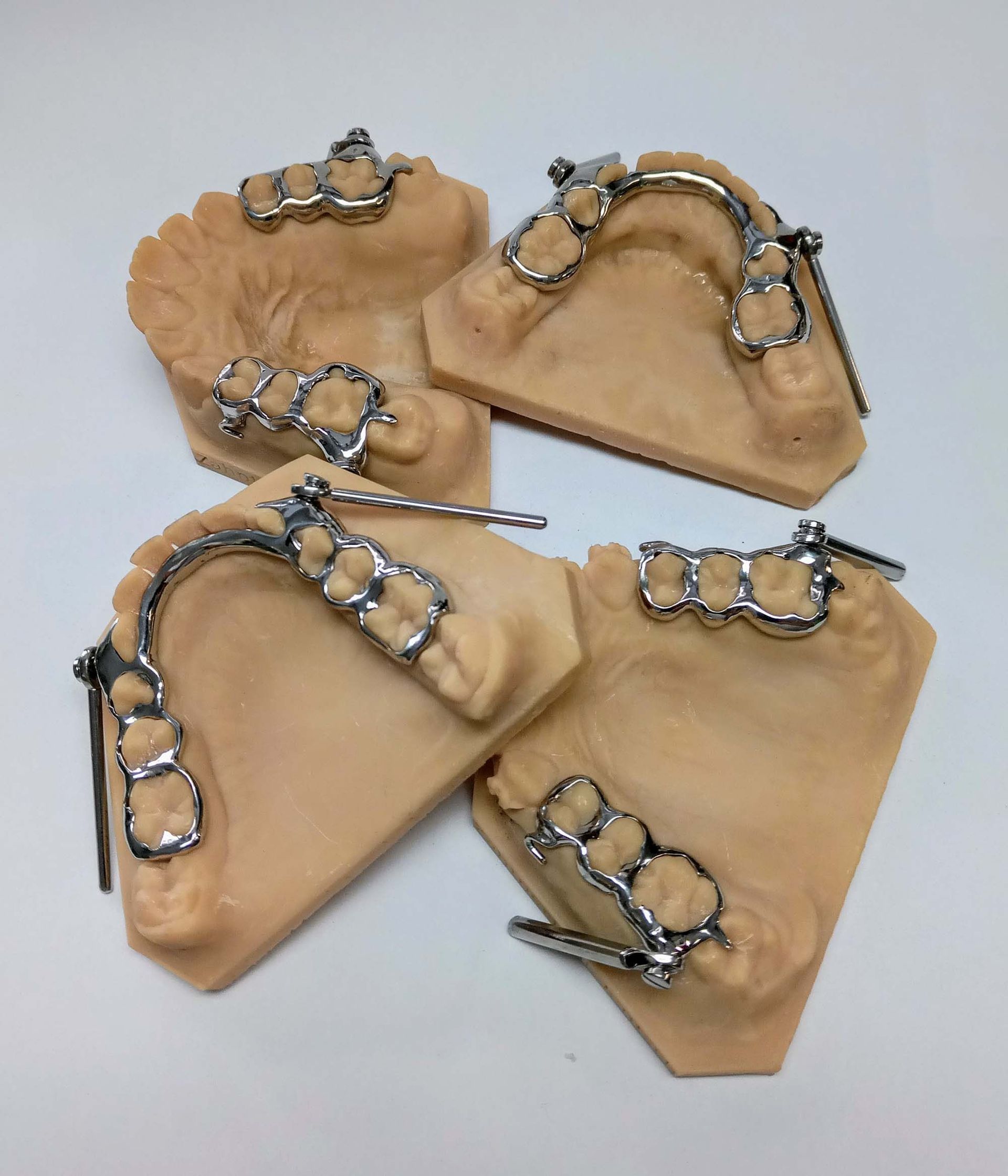 Herbstscharnier - Zahntechnik Jentsch in Brig-Glis