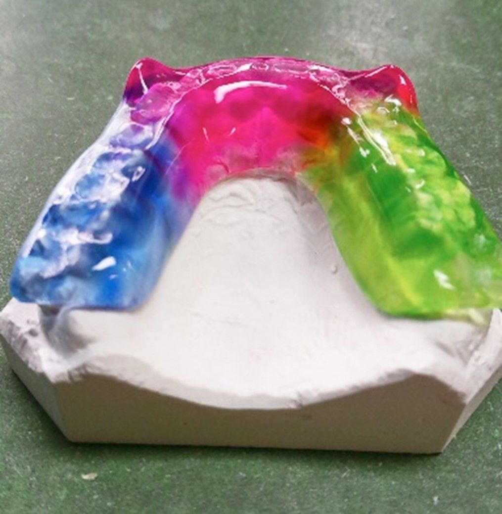 Michiganschiene - Zahntechnik Jentsch in Brig-Glis