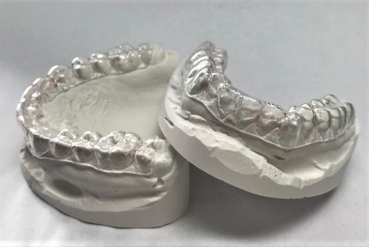 Lingualbogen - Zahntechnik Jentsch in Brig-Glis