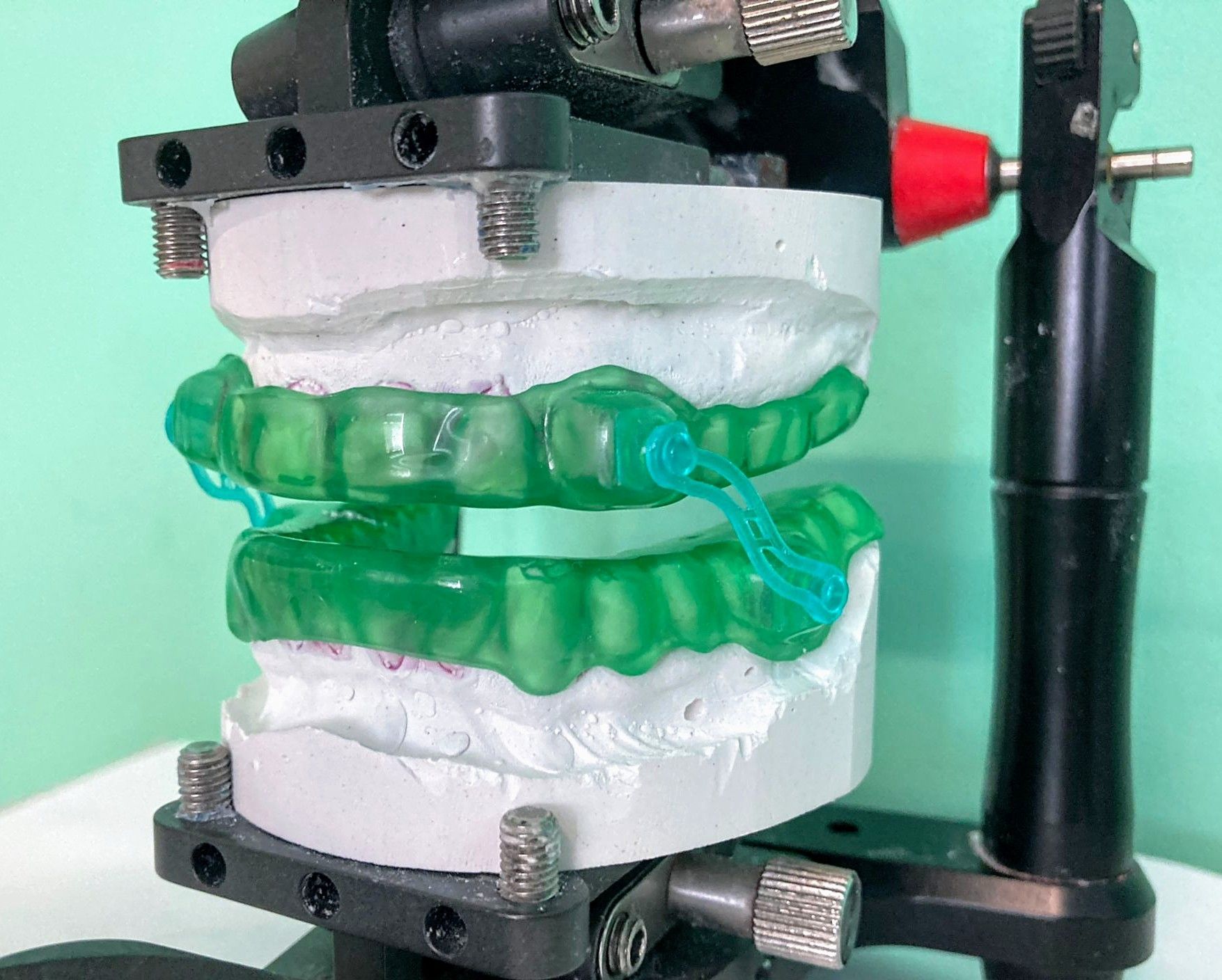 Schnarchschiene - Zahntechnik Jentsch in Brig-Glis