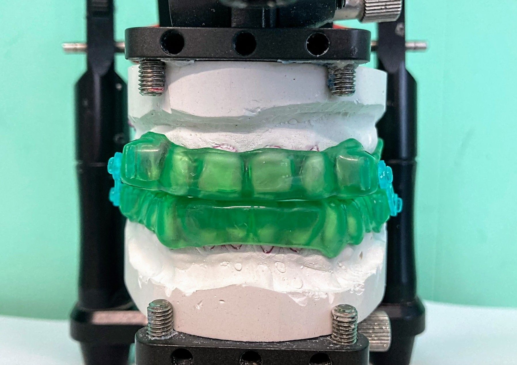 Schnarchschiene - Zahntechnik Jentsch in Brig-Glis