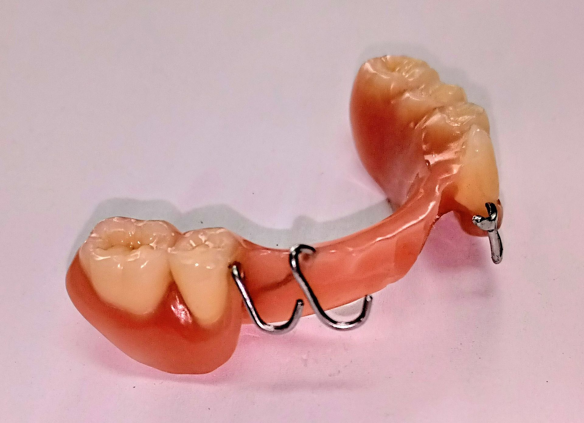 Teilprothese - Zahntechnik Jentsch in Brig-Glis