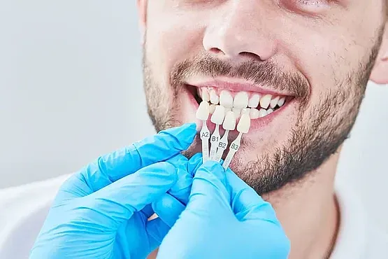 Un hombre se está blanqueando los dientes con un dentista.
