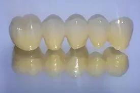 Un primer plano de una fila de dientes sobre una superficie blanca.