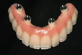Un primer plano de una dentadura postiza con un fondo negro.