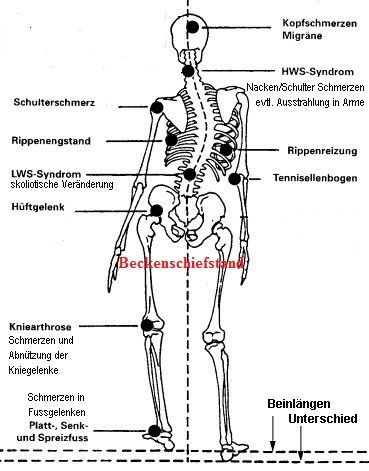 TCM-Boegle