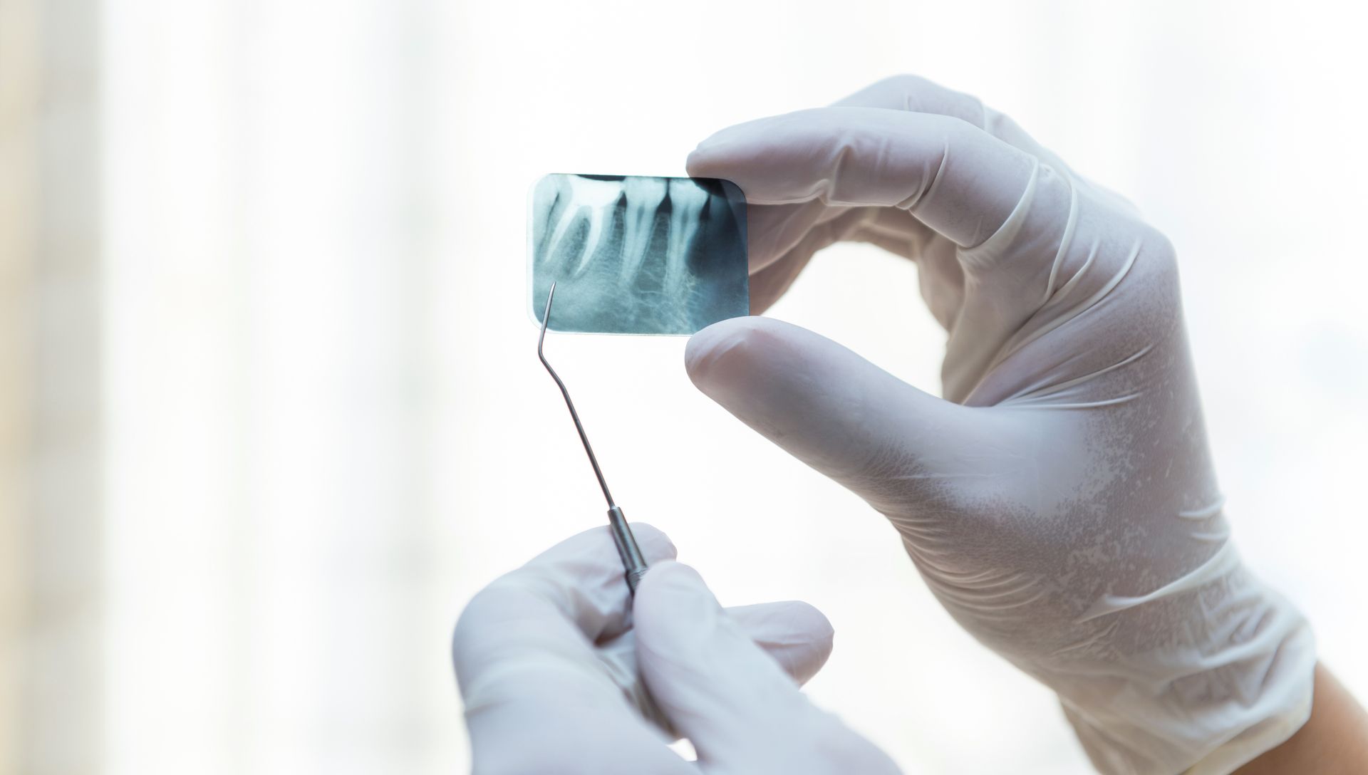 Ein Zahnarzt hält eine Röntgenaufnahme von Zähnen in der Hand