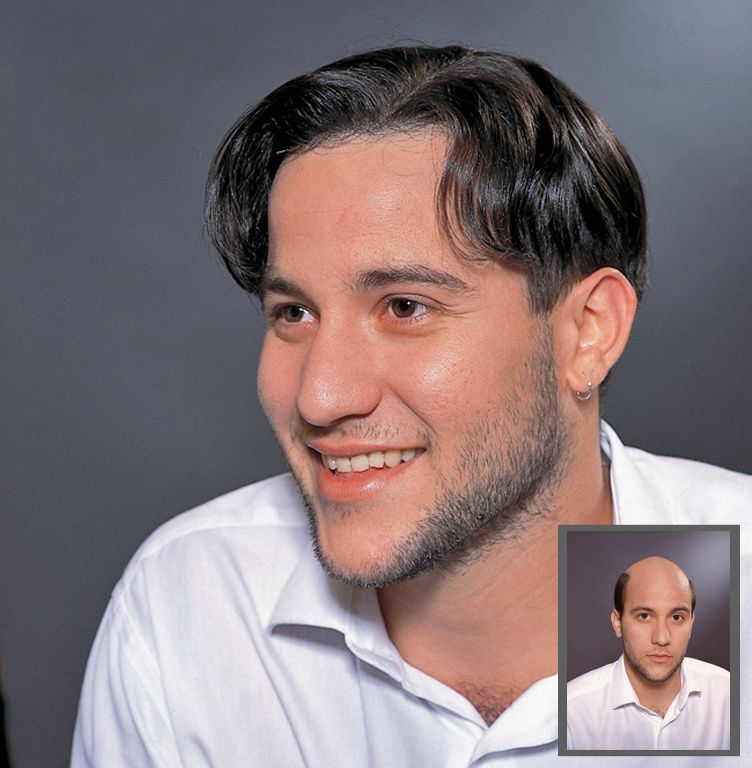 Toupets - Coiffure R. Hofmann - Zürich