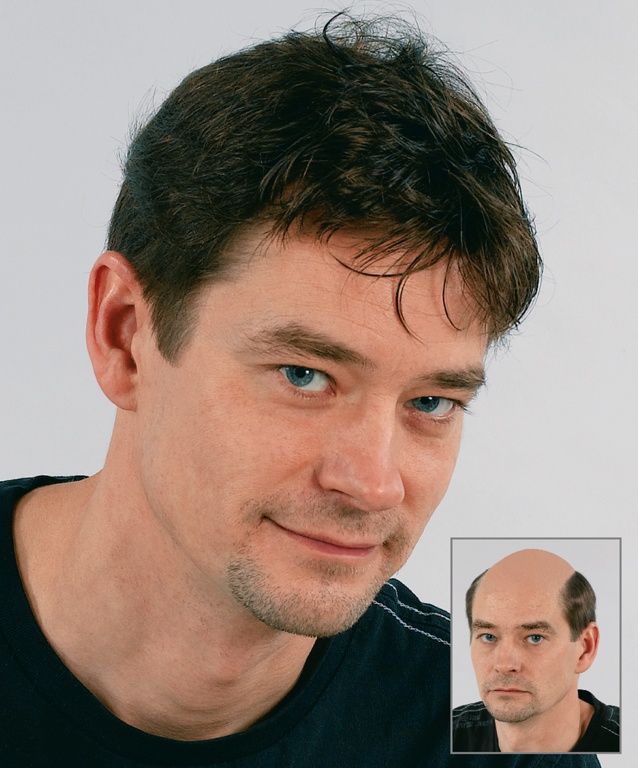 Toupets - Coiffure R. Hofmann - Zürich