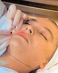 Una mujer está recibiendo un tratamiento facial en una cama de hospital.