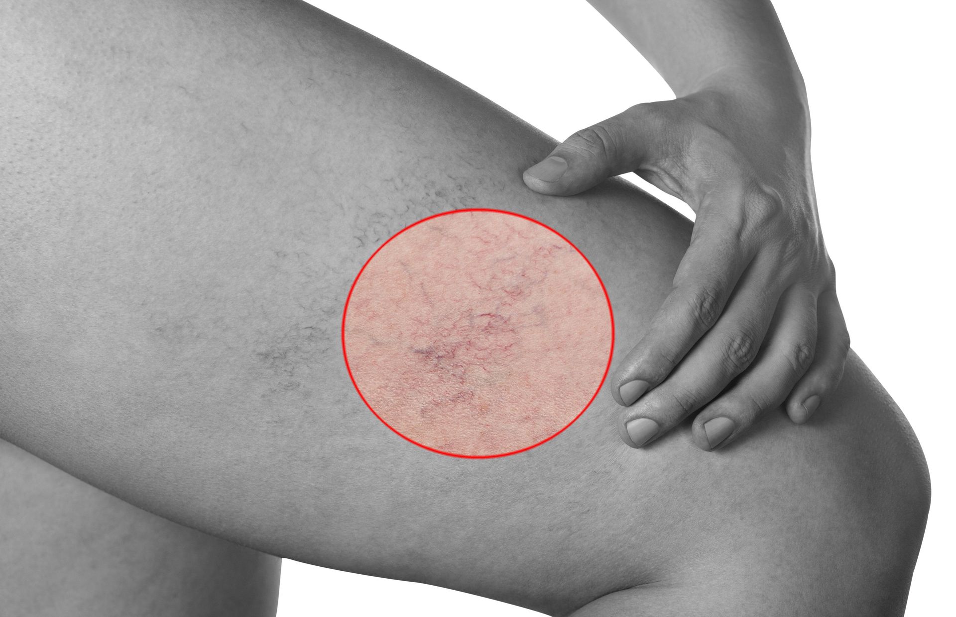Una mujer sostiene su pierna con un círculo rojo alrededor de ella.