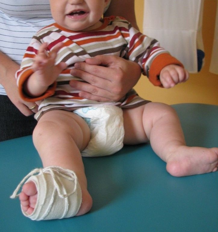 Physiotherapie mit Bänder und Bällen