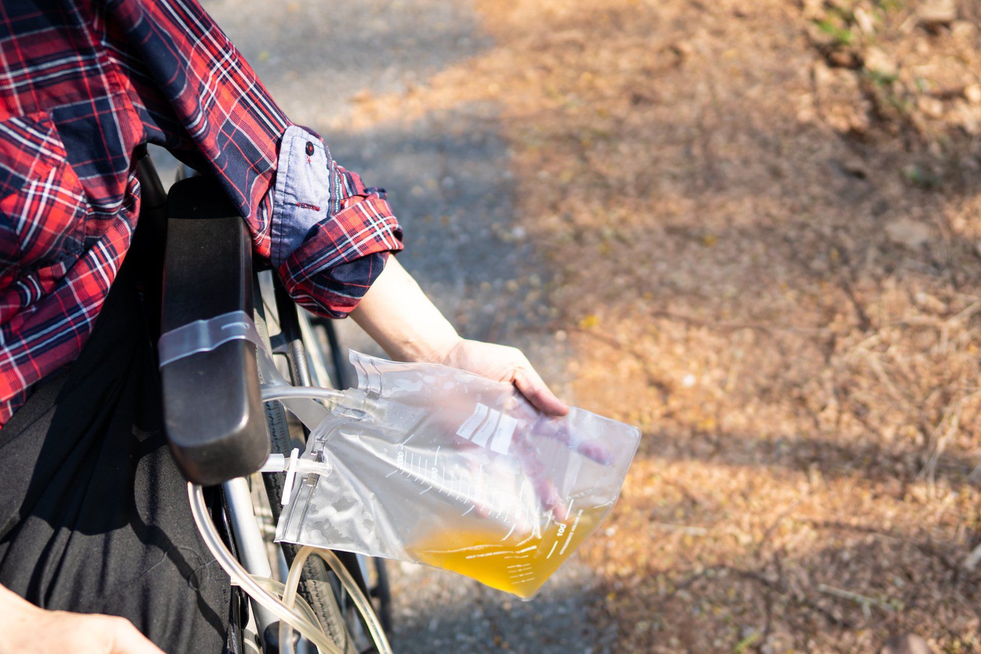 Personne handicapée en fauteuil roulant avec poche d'urine