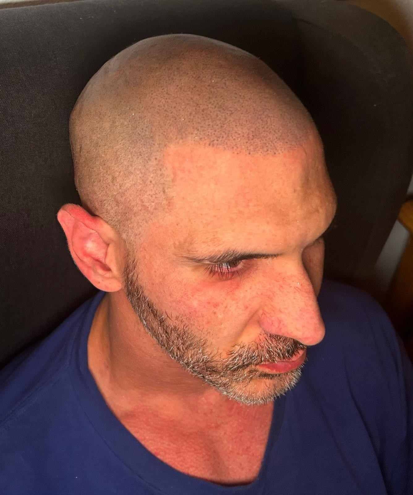 Hombre con la cabeza rapada y barba corta, mirando hacia abajo, con camisa azul, en el interior oscuro de un coche.