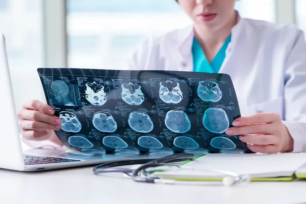 Un médico está mirando una radiografía del cerebro de una persona.