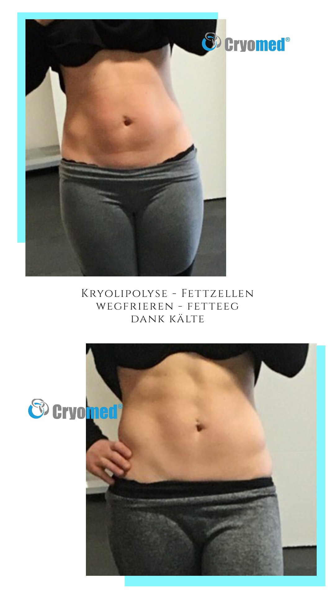 Vorher-Nachher-Kunden Bilder