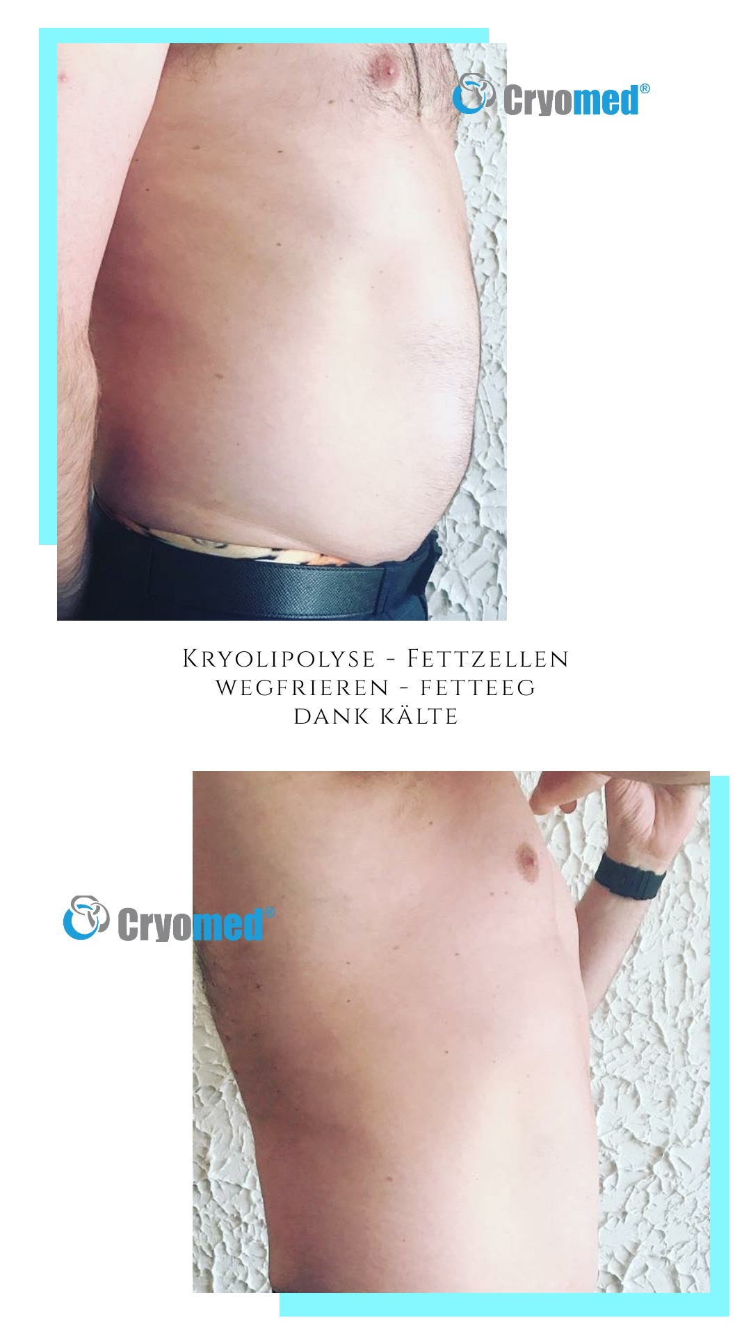 Vorher-Nachher-Kunden Bilder