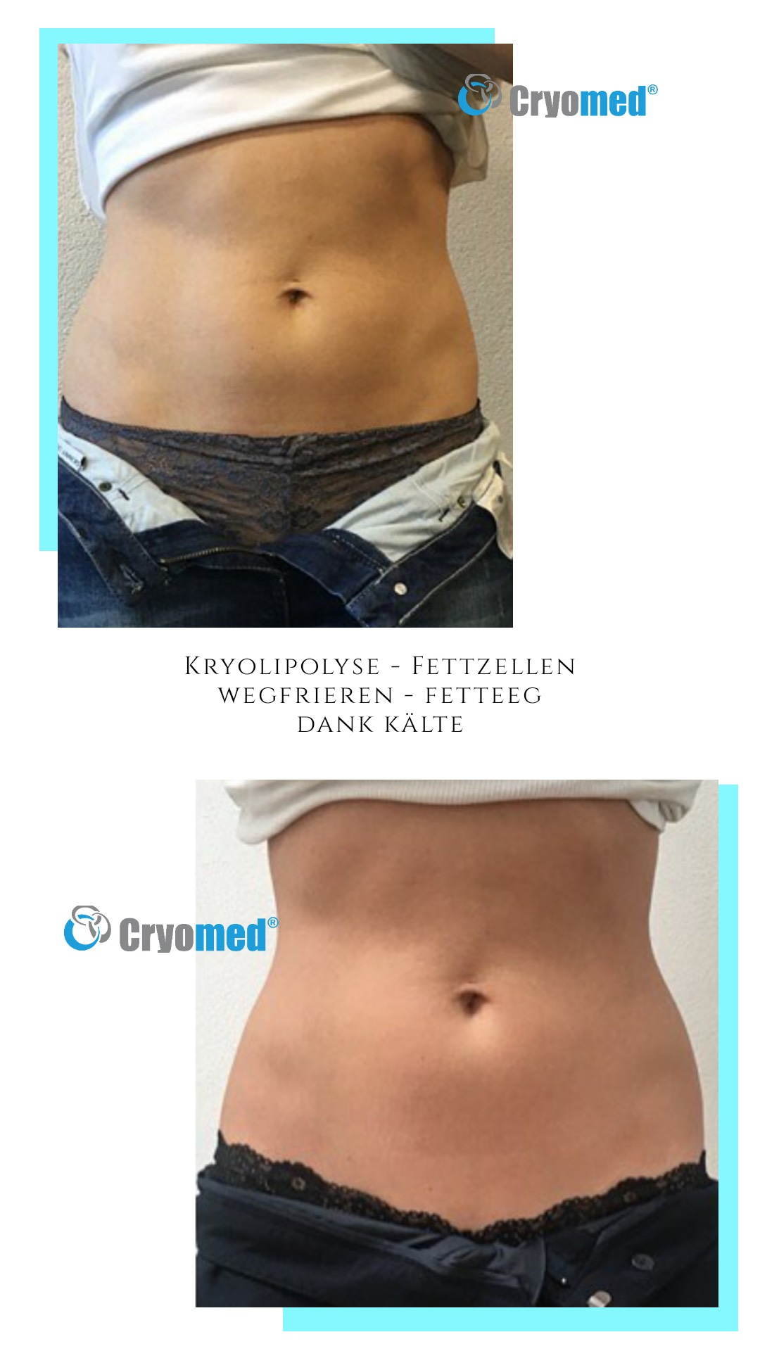 Vorher-Nachher-Kunden Bilder