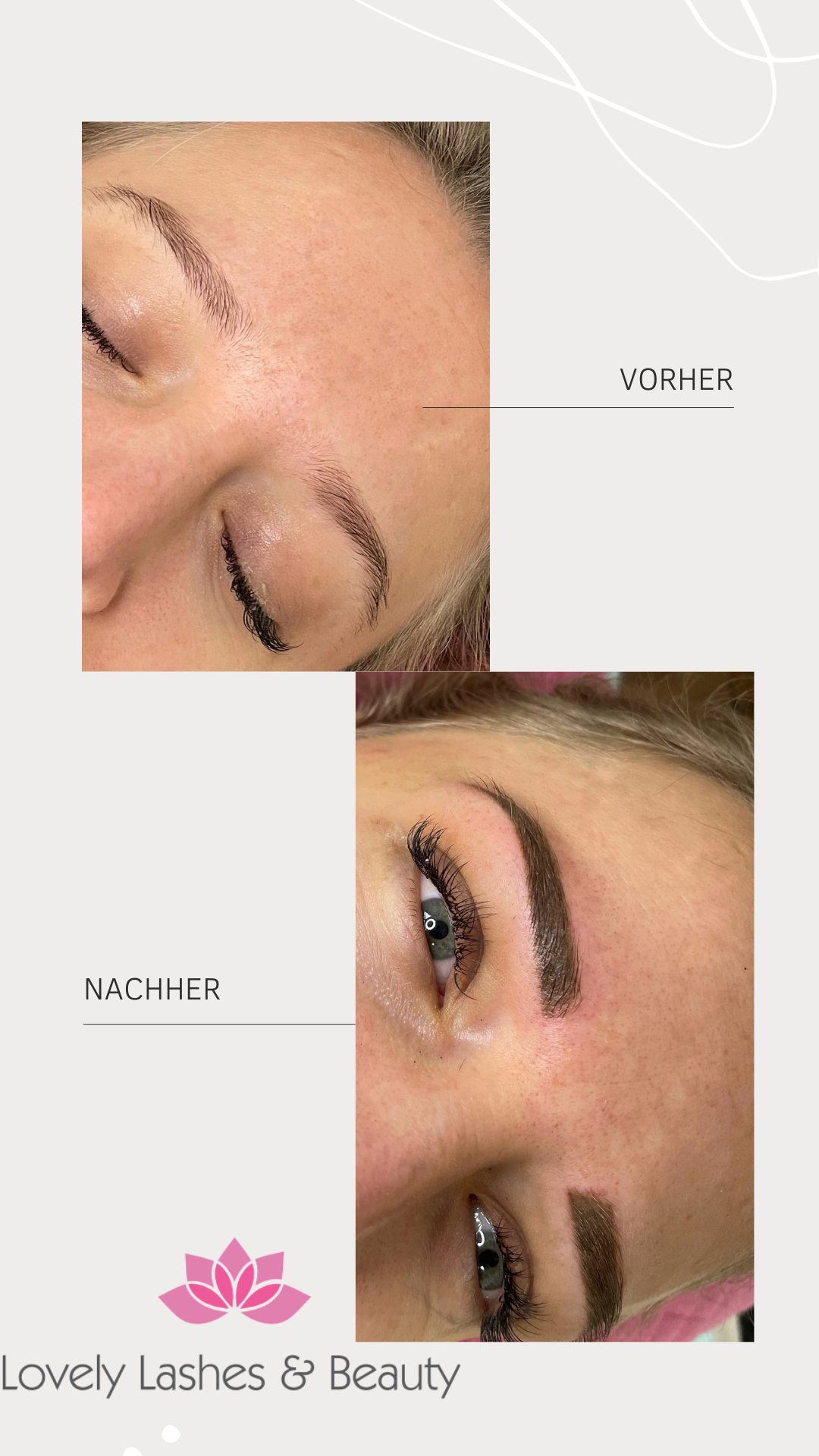 Vorher Nachherbild Kosmetik