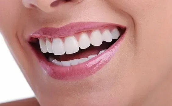 Estética Dentária