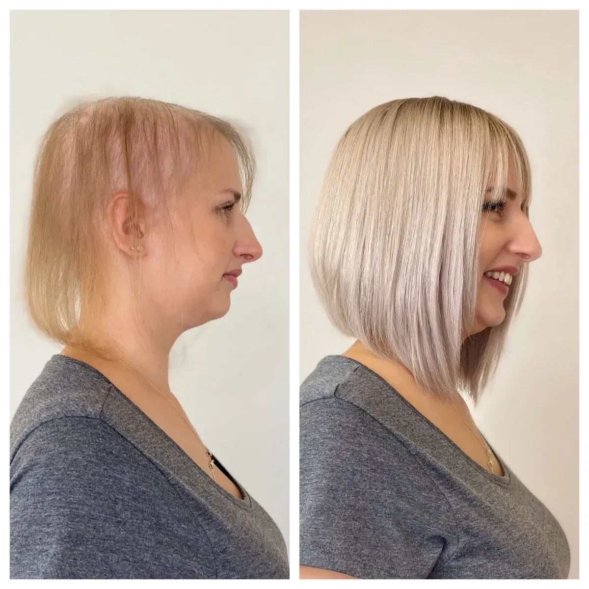 Antes y después, lado a lado: Mujer con cabello ralo, con un corte bob rubio, estilizado y texturizado. Sonríe.