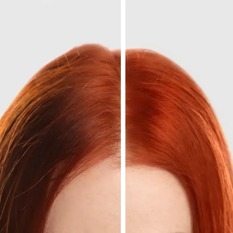 Comparación de un cuero cabelludo de cabello oscuro con y sin escamas visibles; lado a lado.