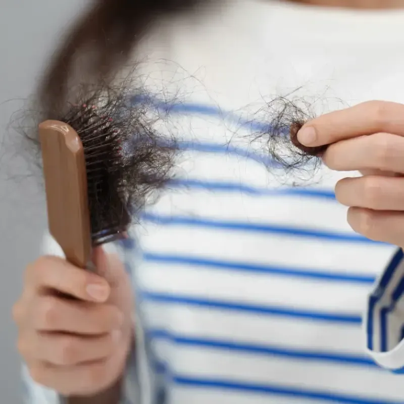 Persona que sostiene un puñado de cabello oscuro, con un peine en la mano, posiblemente indicando pérdida de cabello.