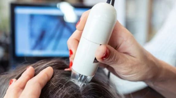 Cuero cabelludo de un paciente con un microscopio digital; una pantalla de computadora muestra imágenes ampliadas.