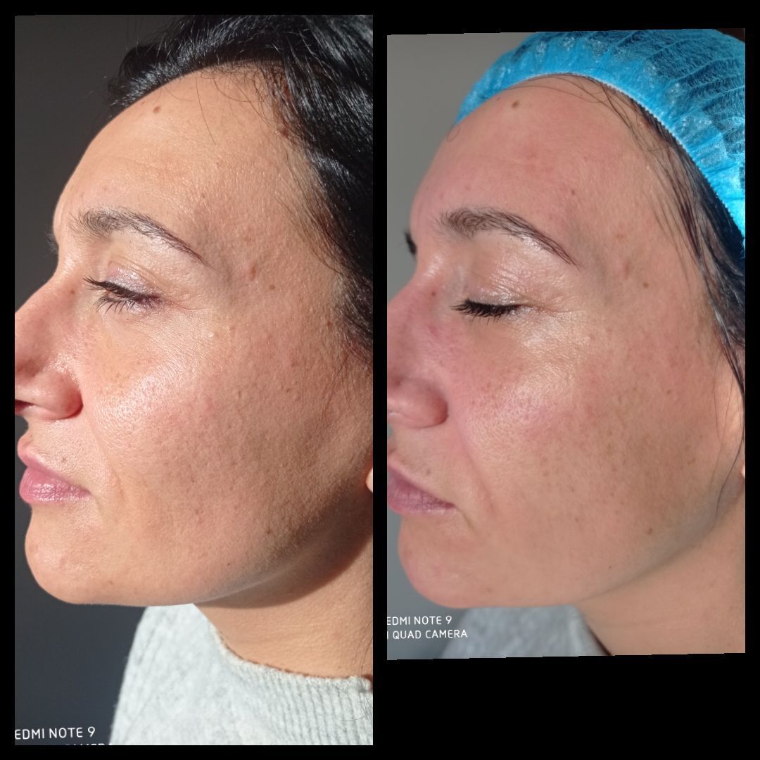DermaBeauty, maquillage permanent | Conthey
