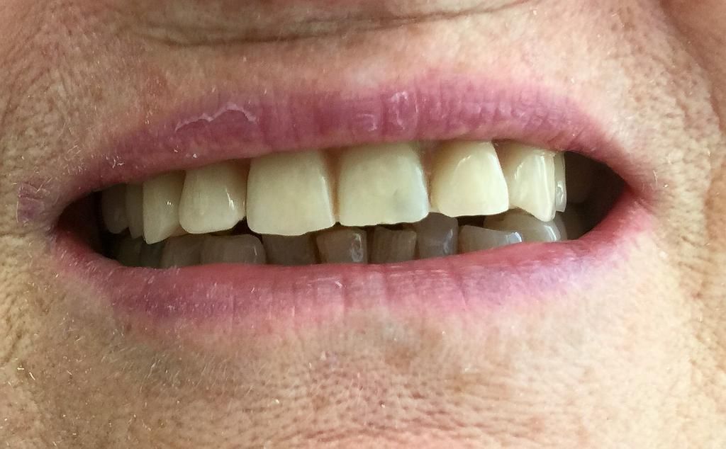 Pont Provisoire le jour de l'intervention