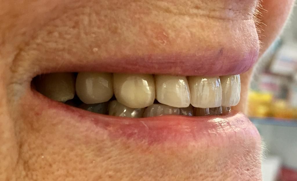 Vues du Pont Définitif