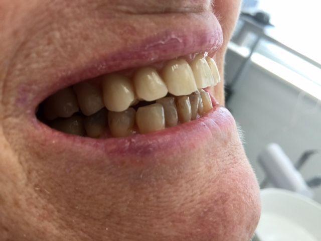 Pont Provisoire le jour de l'intervention