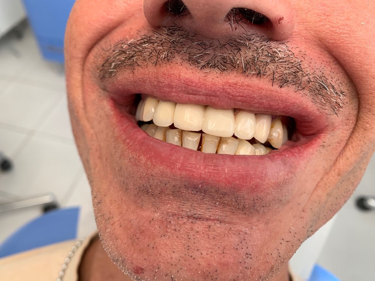 Pont Provisoire en place (jour de l'intervention)