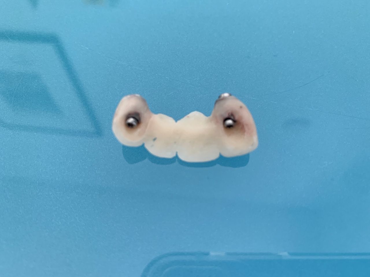 Pont Provisoire réalisé au cabinet