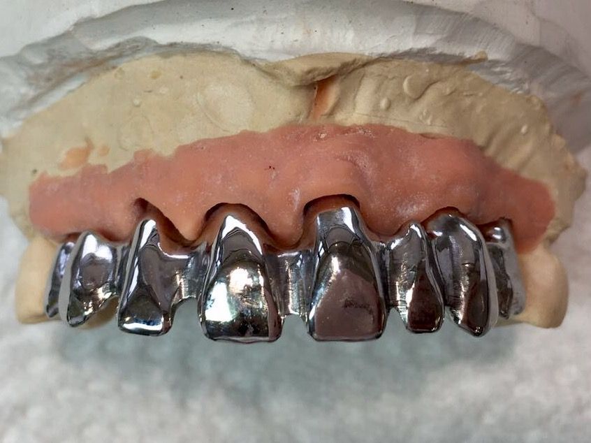 Essai du pont définitif à 3 mois